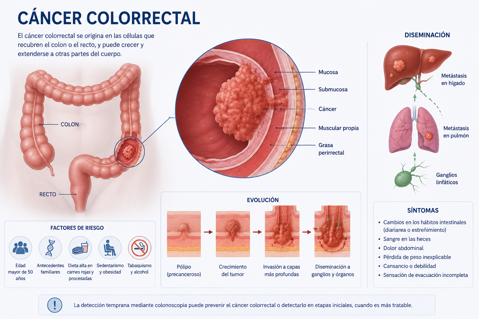 Cáncer colorrectal