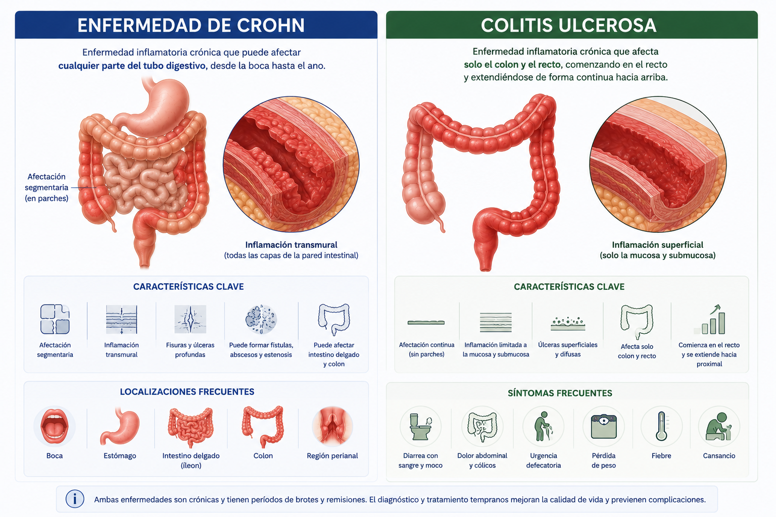 Enfermedad inflamatoria intestinal